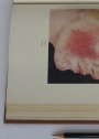 Diseases of the Skin. Volume 1 and 2.