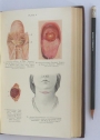 The Tongue and Its Diseases.