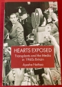 Hearts Exposed: Transplants and the Media in 1960s Britain.