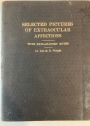 Selected Pictures of Extraocular Affections: From the Museum of the Government Ophthalmic Hospital, Madras, with Explanatory Notes.